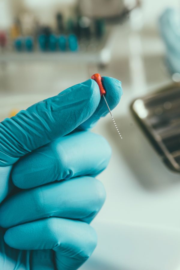 Traitements endodontiques à Cluj-Napoca